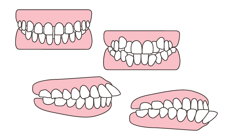 歯並び