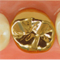 金18K